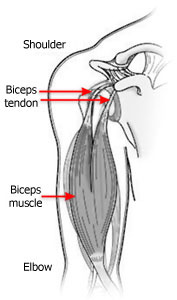 Bicep Tendon