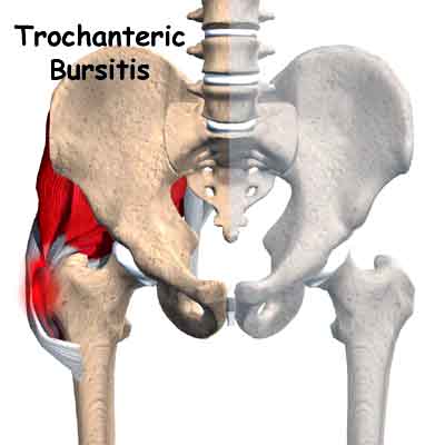 What are common causes of pain in the right hip?