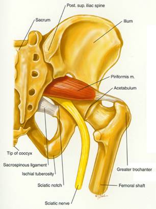 Piriformis Syndrome Severe Buttocks Pain My Cms