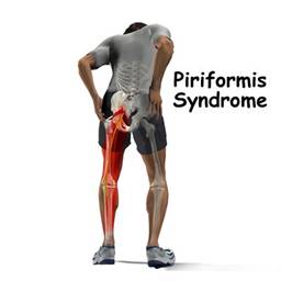 piriformis